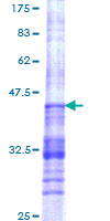 TIAF1 Protein - 12.5% SDS-PAGE Stained with Coomassie Blue.