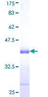TIAL1 Protein - 12.5% SDS-PAGE Stained with Coomassie Blue.