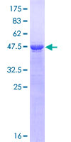TIAM2 Protein - 12.5% SDS-PAGE Stained with Coomassie Blue.