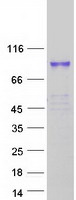TIAM2 Protein - Purified recombinant protein TIAM2 was analyzed by SDS-PAGE gel and Coomassie Blue Staining