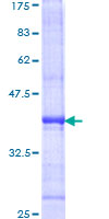 TICAM1 / TRIF Protein - 12.5% SDS-PAGE Stained with Coomassie Blue.