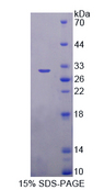 TICAM1 / TRIF Protein - Recombinant  Toll Like Receptor Adaptor Molecule 1 By SDS-PAGE