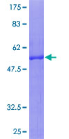 TICAM2 / TRAM Protein - 12.5% SDS-PAGE of human TICAM2 stained with Coomassie Blue