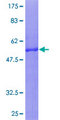 TICAM2 / TRAM Protein - 12.5% SDS-PAGE of human TICAM2 stained with Coomassie Blue