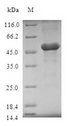 TICAM2 / TRAM Protein - (Tris-Glycine gel) Discontinuous SDS-PAGE (reduced) with 5% enrichment gel and 15% separation gel.