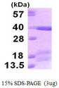 TICAM2 / TRAM Protein