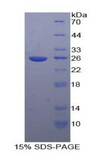 TICAM2 / TRAM Protein - Recombinant Toll Like Receptor Adaptor Molecule 2 By SDS-PAGE