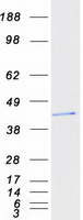 TICAM2 / TRAM Protein - Purified recombinant protein TICAM2 was analyzed by SDS-PAGE gel and Coomassie Blue Staining