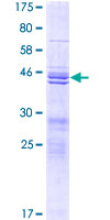 TIFA Protein - 12.5% SDS-PAGE of human TIFA stained with Coomassie Blue