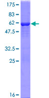 TIGAR Protein - 12.5% SDS-PAGE of human C12orf5 stained with Coomassie Blue
