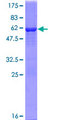 TIGAR Protein - 12.5% SDS-PAGE of human C12orf5 stained with Coomassie Blue