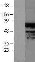 TIGD4 Protein - Western validation with an anti-DDK antibody * L: Control HEK293 lysate R: Over-expression lysate