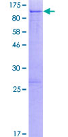 TIGD4 Protein - 12.5% SDS-PAGE of human TIGD4 stained with Coomassie Blue
