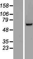 TIGD6 Protein - Western validation with an anti-DDK antibody * L: Control HEK293 lysate R: Over-expression lysate