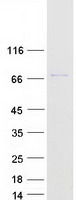 TIGD6 Protein - Purified recombinant protein TIGD6 was analyzed by SDS-PAGE gel and Coomassie Blue Staining