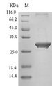 TIGIT Protein - (Tris-Glycine gel) Discontinuous SDS-PAGE (reduced) with 5% enrichment gel and 15% separation gel.