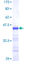 TIMELESS Protein - 12.5% SDS-PAGE Stained with Coomassie Blue.