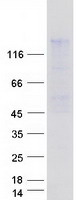 TIMELESS Protein - Purified recombinant protein TIMELESS was analyzed by SDS-PAGE gel and Coomassie Blue Staining