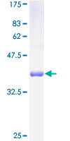 TIMM10B / FXC1 Protein - 12.5% SDS-PAGE of human FXC1 stained with Coomassie Blue