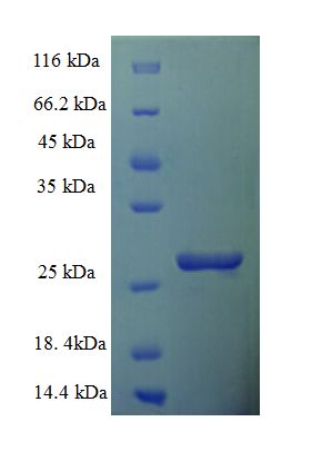 TIMM10B / FXC1 Protein