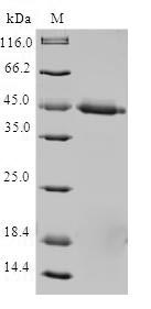 TIMM17A / TIM17 Protein - (Tris-Glycine gel) Discontinuous SDS-PAGE (reduced) with 5% enrichment gel and 15% separation gel.