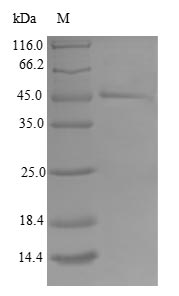 TIMM17B Protein - (Tris-Glycine gel) Discontinuous SDS-PAGE (reduced) with 5% enrichment gel and 15% separation gel.