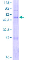 TIMM21 Protein - 12.5% SDS-PAGE of human C18orf55 stained with Coomassie Blue