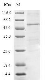 TIMM21 Protein - (Tris-Glycine gel) Discontinuous SDS-PAGE (reduced) with 5% enrichment gel and 15% separation gel.