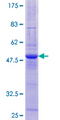 TIMM22 Protein - 12.5% SDS-PAGE of human TIMM22 stained with Coomassie Blue