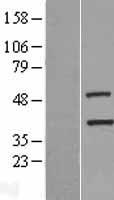 TIMM50 Protein - Western validation with an anti-DDK antibody * L: Control HEK293 lysate R: Over-expression lysate