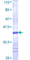 TIMM50 Protein - 12.5% SDS-PAGE Stained with Coomassie Blue.
