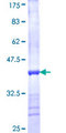 TIMM50 Protein - 12.5% SDS-PAGE Stained with Coomassie Blue.