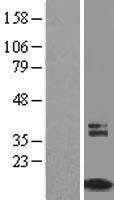 TIMM8A Protein - Western validation with an anti-DDK antibody * L: Control HEK293 lysate R: Over-expression lysate
