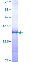 TIMM8A Protein - 12.5% SDS-PAGE Stained with Coomassie Blue.