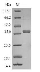 TIMM8A Protein - (Tris-Glycine gel) Discontinuous SDS-PAGE (reduced) with 5% enrichment gel and 15% separation gel.