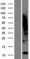 TIMM8B Protein - Western validation with an anti-DDK antibody * L: Control HEK293 lysate R: Over-expression lysate
