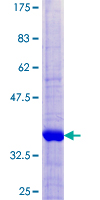 TIMM8B Protein - 12.5% SDS-PAGE of human TIMM8B stained with Coomassie Blue