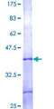 TIMM9 Protein - 12.5% SDS-PAGE Stained with Coomassie Blue.