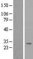 TIMMDC1 Protein - Western validation with an anti-DDK antibody * L: Control HEK293 lysate R: Over-expression lysate