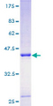 TIMP1 Protein - 12.5% SDS-PAGE of human TIMP1 stained with Coomassie Blue