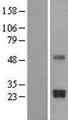 TIMP2 Protein - Western validation with an anti-DDK antibody * L: Control HEK293 lysate R: Over-expression lysate