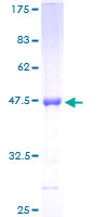 TIMP2 Protein - 12.5% SDS-PAGE of human TIMP2 stained with Coomassie Blue