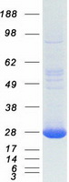 TIMP2 Protein - Purified recombinant protein TIMP2 was analyzed by SDS-PAGE gel and Coomassie Blue Staining