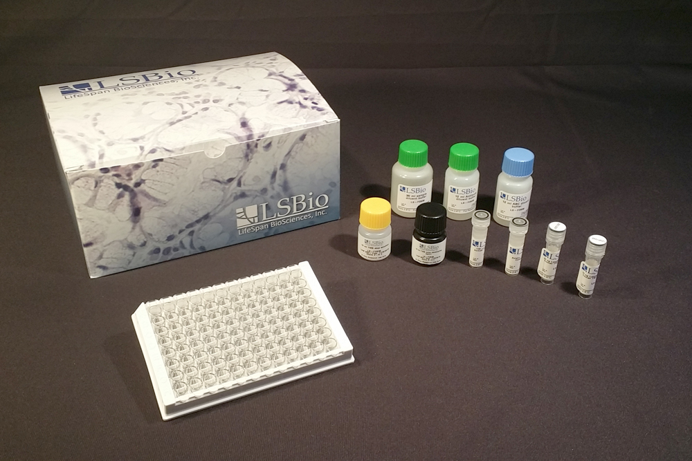 TIMP2 ELISA Kit