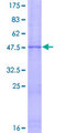 TIMP3 Protein - 12.5% SDS-PAGE of human TIMP3 stained with Coomassie Blue