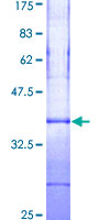 TIMP3 Protein - 12.5% SDS-PAGE Stained with Coomassie Blue.