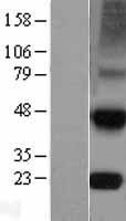 TIMP4 Protein - Western validation with an anti-DDK antibody * L: Control HEK293 lysate R: Over-expression lysate