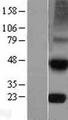 TIMP4 Protein - Western validation with an anti-DDK antibody * L: Control HEK293 lysate R: Over-expression lysate