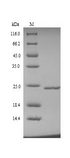 TIMP4 Protein - (Tris-Glycine gel) Discontinuous SDS-PAGE (reduced) with 5% enrichment gel and 15% separation gel.