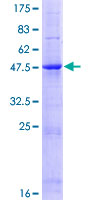TIMP4 Protein - 12.5% SDS-PAGE of human TIMP4 stained with Coomassie Blue